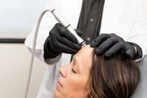 A close up on the CytoPeel's specialized diamond tip during hydradermabrasion. This step, the key component on a Hydrafacial near Champlin, is 1 of 5 during a CytoPeel session.