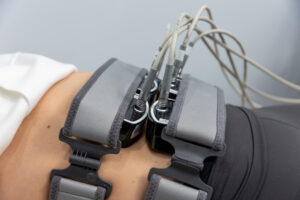 An Enrichment Skin Solution patient undergoes EvolveX, one of our options for body sculpting near Blaine. This treatment tones muscle and reduces fat for a comprehensive body transformation.